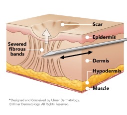 Skin diagram 